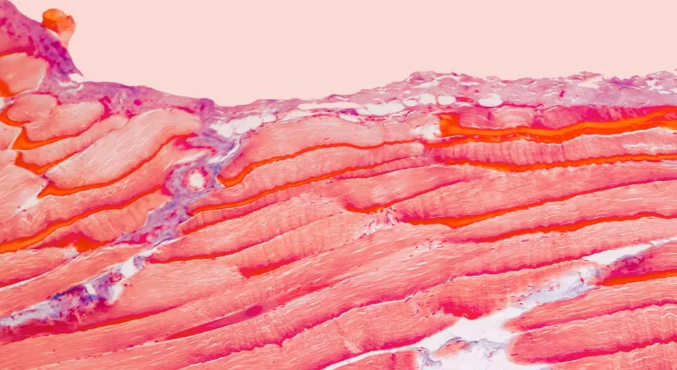 Aus welchen Geweben bestehen unsere Muskeln?