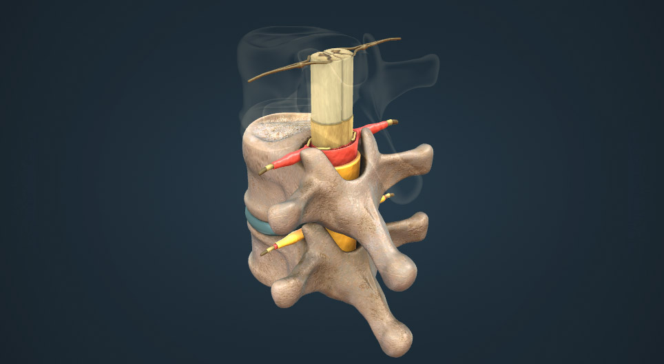 Der Aufbau des Rückenmarks
