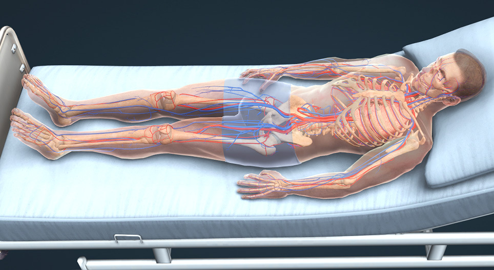 Die tiefe Beinvenenthrombose und die Lungenembolie