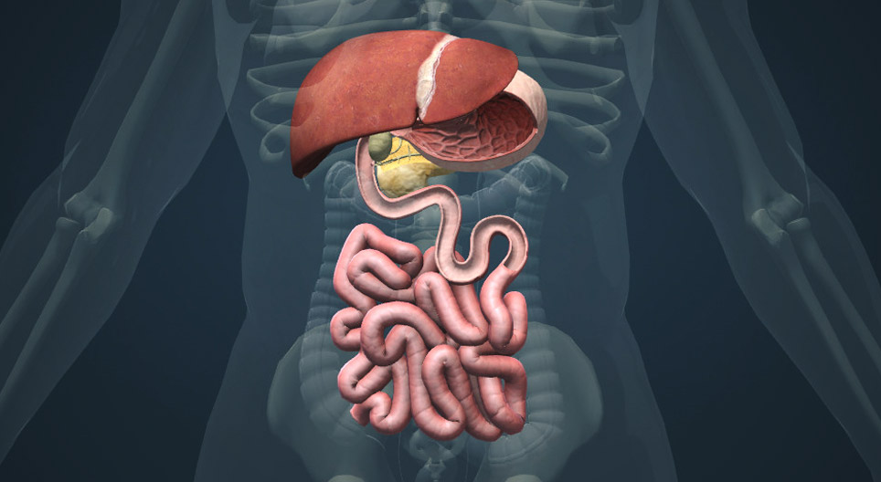 Gallstones