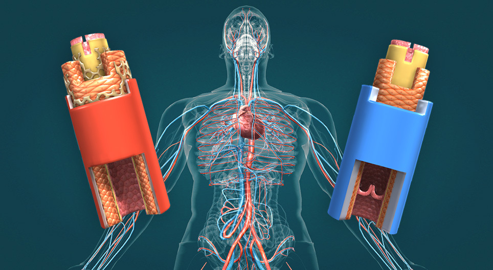 Les vaisseaux sanguins