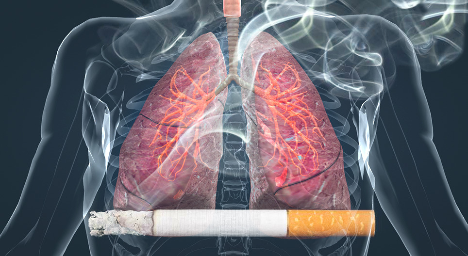 L'effet du tabac sur les poumons