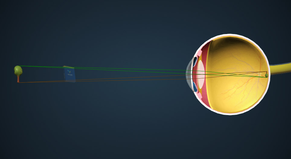Le mécanisme de la vue