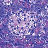 Groep cellen in de alvleesklier die insuline produceren