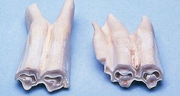 Gefurchte Backenzähne