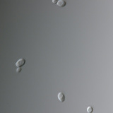 Candida fungus (most commonly causes vaginal infection)