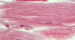 Tendon (vue en coupe longitudinale)