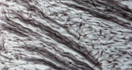 Tissu de fibrocartilage (nez d'un embryon de cochon)