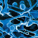 Fasern und weiße Blutkörperchen innerhalb des Lymphknotens