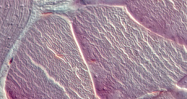 Tendon (vue en coupe)