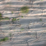 Cellules épidermiques d'une plante