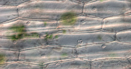 Cellules épidermiques d'une plante