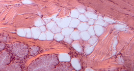 Fettgewebe der Zungenwurzel einer Katze