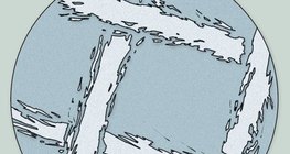 Mikroskopische Aufnahme der Gaze