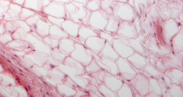 Fettgewebe der Zungenwurzel einer Katze