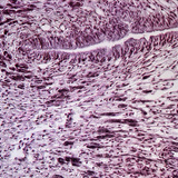 Snail foot cross section