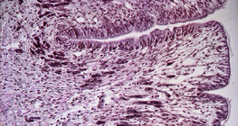 Fuß der Schnecke (Querschnitt)