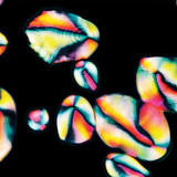 Zetmeelkorrels in aardappel