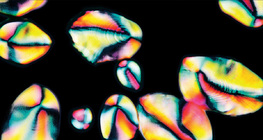 Grains d'amidon dans une pomme de terre