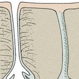 Huidklieren: talgklier