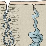 Glandes de la peau: glande de transpiration