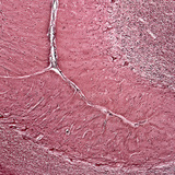 Vue en coupe d'un cervelet humain