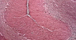 Vue en coupe d'un cervelet humain