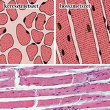 Harántcsíkolt izomszövet