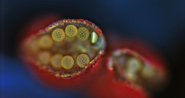 Wunderblüte, geöffneter Staubbeutel (Lichtmikroskop)