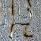 Bot (lengtedoorsnede)