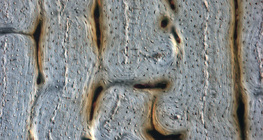 Knochen (Längsschnitt)