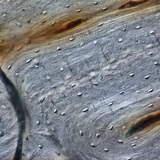 Bot (lengtedoorsnede)