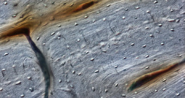 Knochen (Längsschnitt)