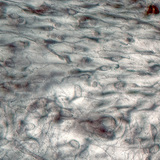 Losmazig bindweefsel