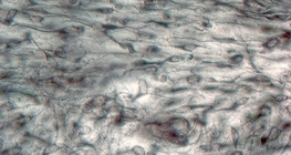 Tissu conjonctif lâche