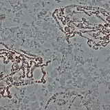 Grote Drosophila chromosomen (uit de speekselklier)