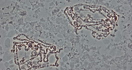 Chromosomes de drosophile géante (prises de la glande salivaire)