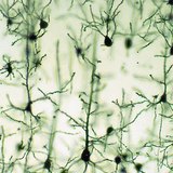 Zenuwcellen in de hersenschors