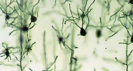 Neuronen der Großhirnrinde