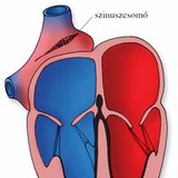 A szív ingerképző és ingerületvezető rendszere