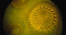 Scolex de ténia (tête) avec crochets et ventouses