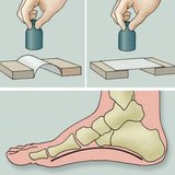 Onderzoek van de voetboog