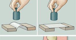 Untersuchung des Fußgewölbes