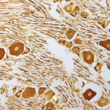 Cellules nerveuses dans le ganglion spinal