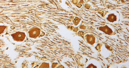 Cellules nerveuses dans le ganglion spinal