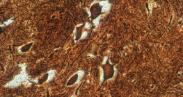 Cellules nerveuses de la moelle épinière (bétail)