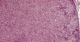 Nebenniere, Gewebeschnitt