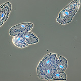 Cellules de muqueuse tapissant la bouche humaine