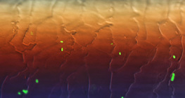 Bactérie E.coli fluorescente sur poil