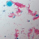 Agent pathogène de la tuberculose (Mycobacterium tuberculosis)
